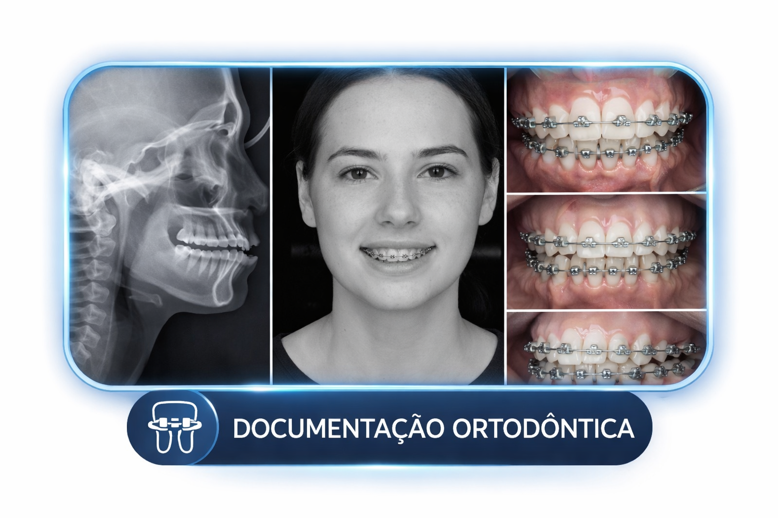 Documentação ortodôntica personalizada